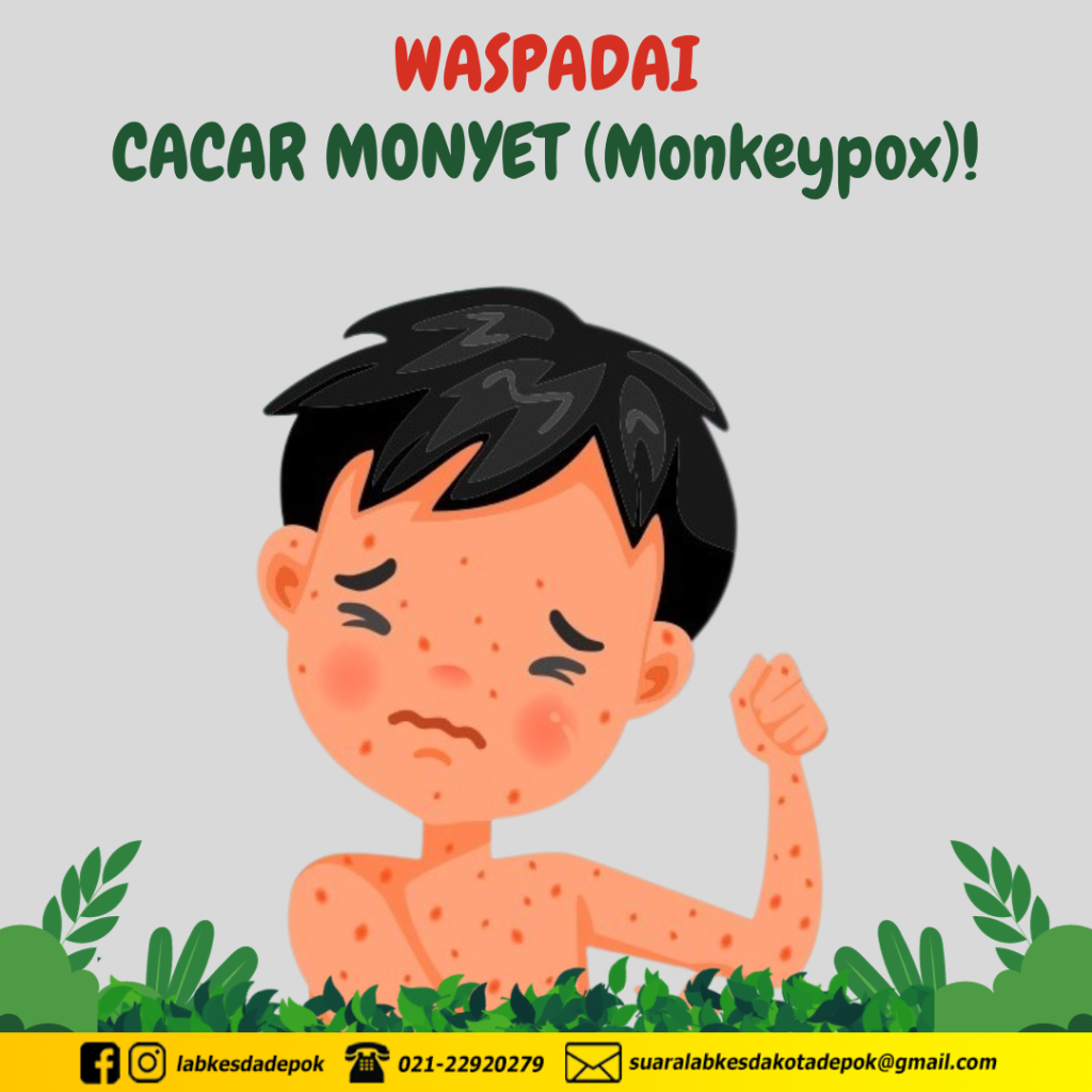 WASPADA! CACAR MONYET (MONKEYPOX) MENGINTAI!